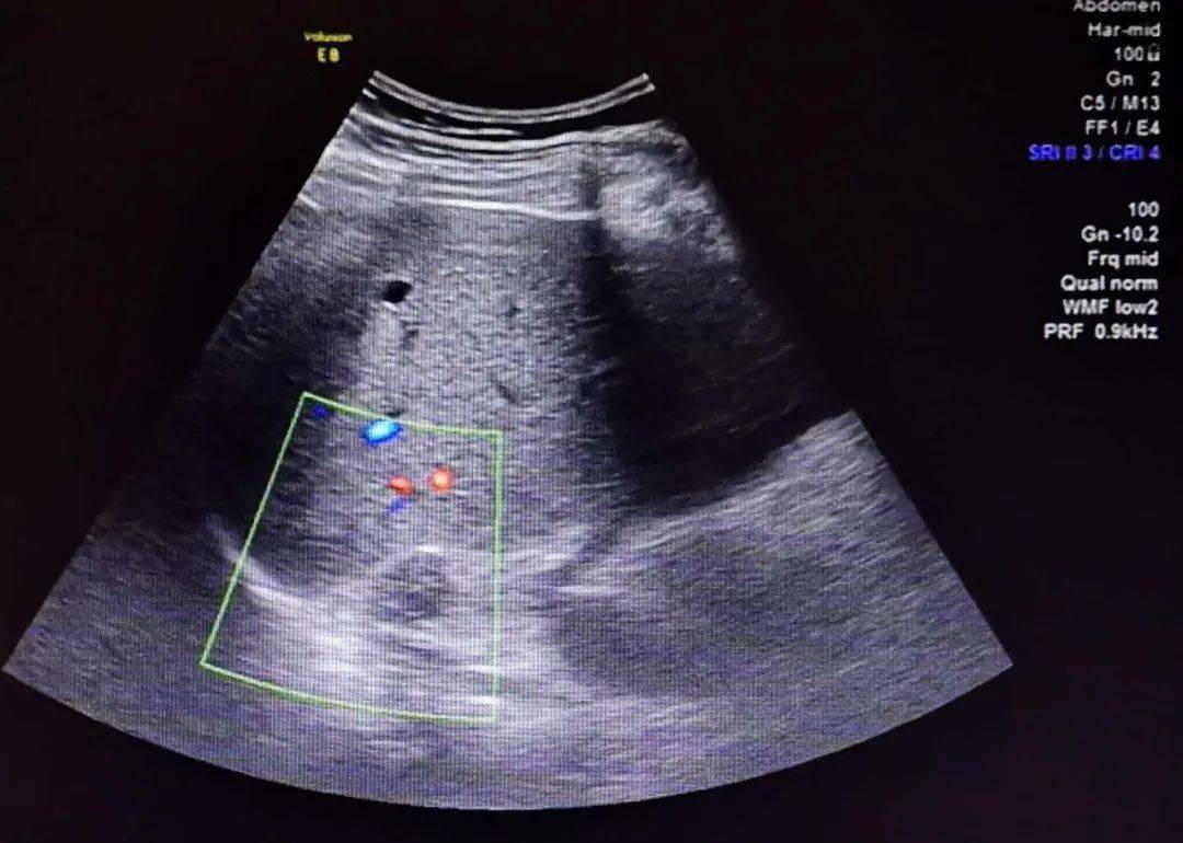 凯美纳，凯美纳是哪个公司生产的